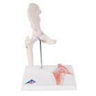 Mini Hip Joint with Cross Section